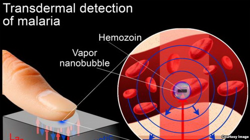 นักวิจัยสหรัฐ คิดค้นพัฒนาการตรวจหาเชื้อมาลาเรีย ด้วยวิธีใหม่โดยใช้เครื่องสแกนเลเซอร์